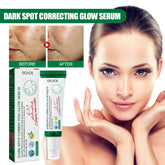 Brightening Serum – Helps Even Skin Tone & Boost Radiance - Charms