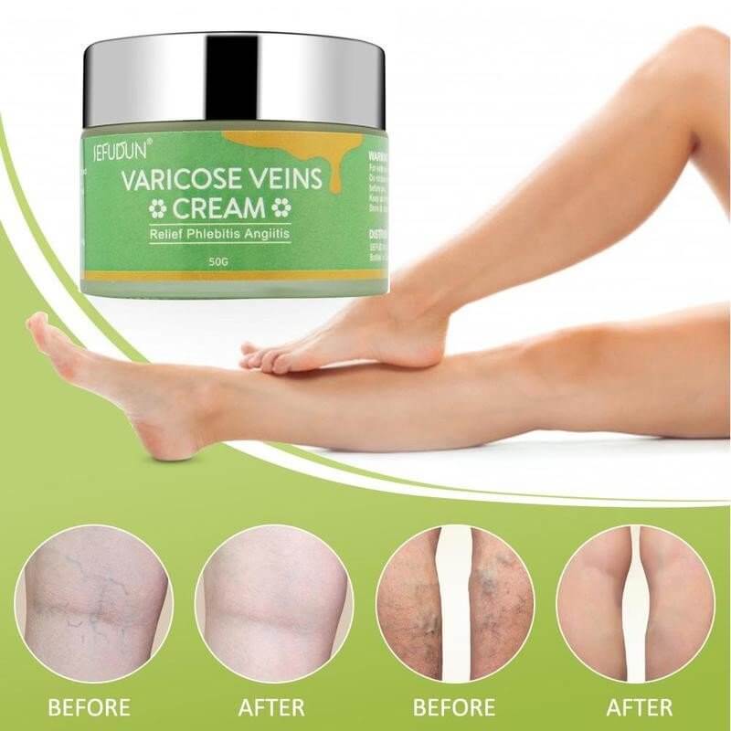 Image of varicose vein cream jar with before and after images showing skin improvement.