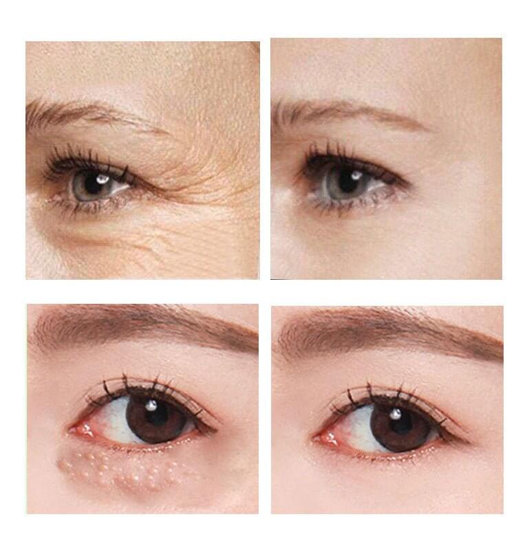 Brightening & Firming Eye Cream - Charms