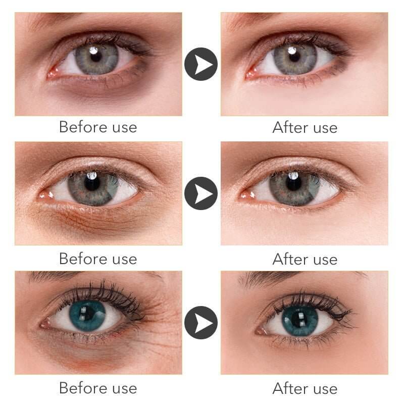 Before and after results showcasing the effectiveness of brightening eye cream on dark circles and fine lines.
