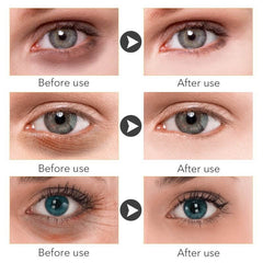 Before and after results showcasing the effectiveness of brightening eye cream on dark circles and fine lines.