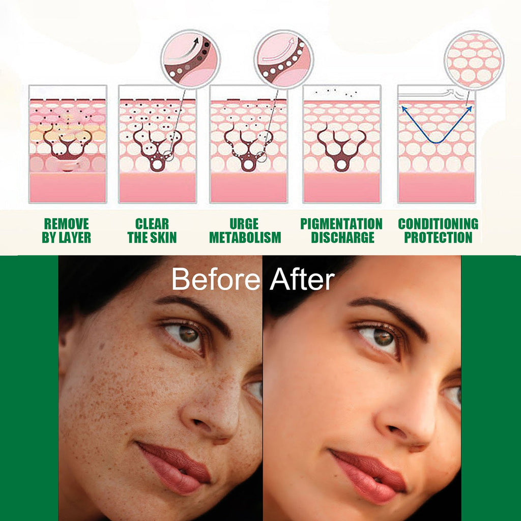 Brightening Serum – Helps Even Skin Tone & Boost Radiance - Charms