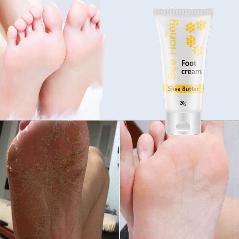 Honey foot repair cream in a tube with smooth and healthy feet showing before and after the use of foot cream.