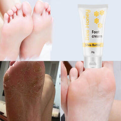 Honey foot repair cream in a tube with smooth and healthy feet showing before and after the use of foot cream.