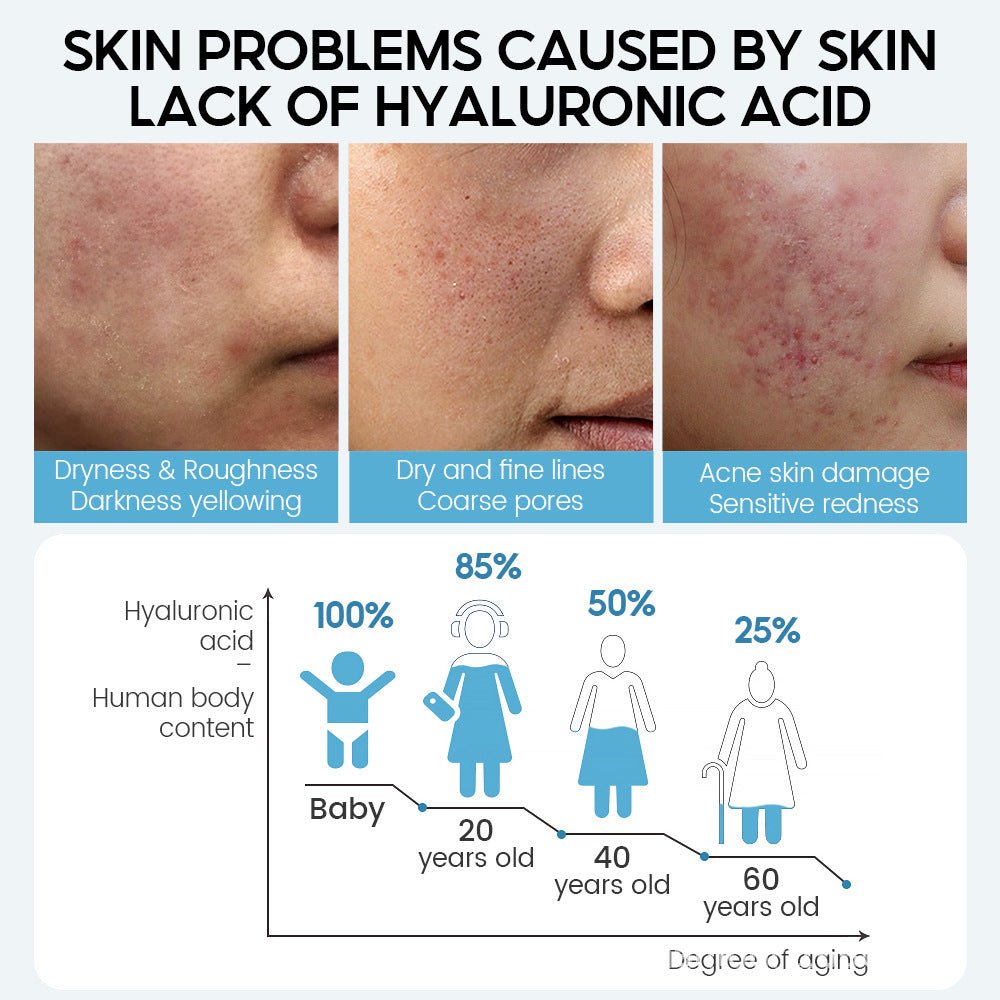 Hyaluronic Acid Face Serum – Anti - Aging, Pore Minimising & Deep Hydration - Charms