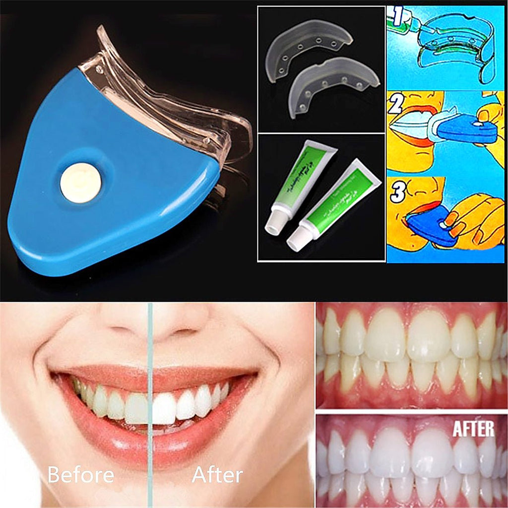 LED Teeth Whitening Kit – Professional Cold Light Bleaching System - Charms