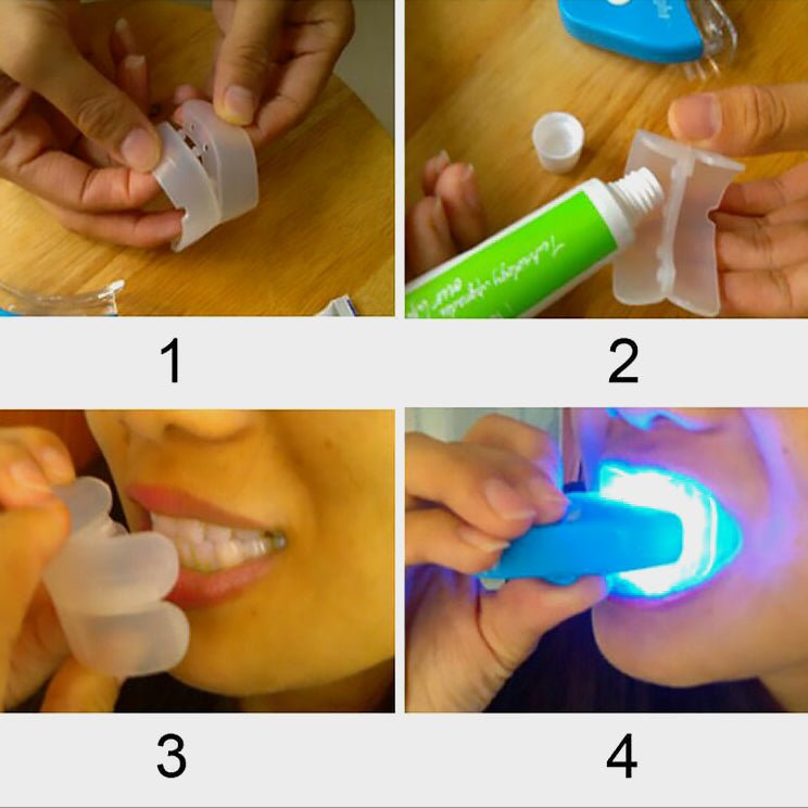 LED Teeth Whitening Kit – Professional Cold Light Bleaching System - Charms